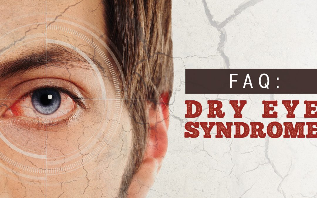 FAQ: Dry Eye Syndrome 